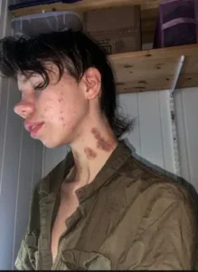 Rancid norway onlyfans